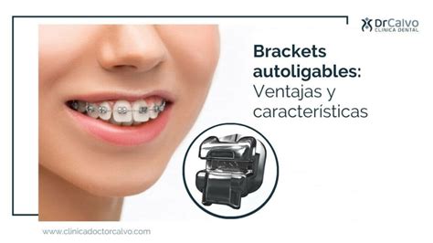 tratamiento de brackets autoligables